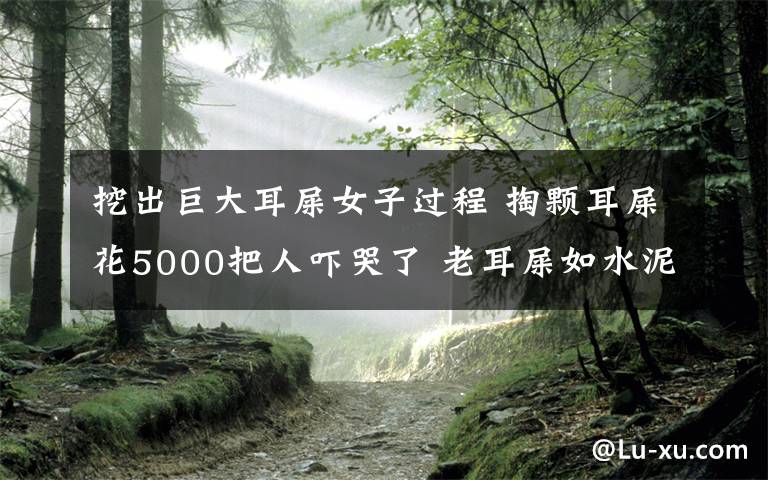 挖出巨大耳屎女子过程 掏颗耳屎花5000把人吓哭了 老耳屎如水泥封住耳道吓懵医生