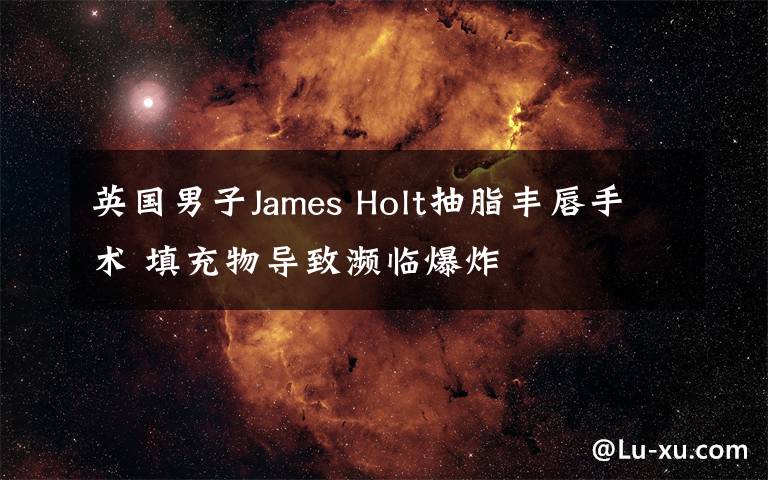 英国男子James Holt抽脂丰唇手术 填充物导致濒临爆炸