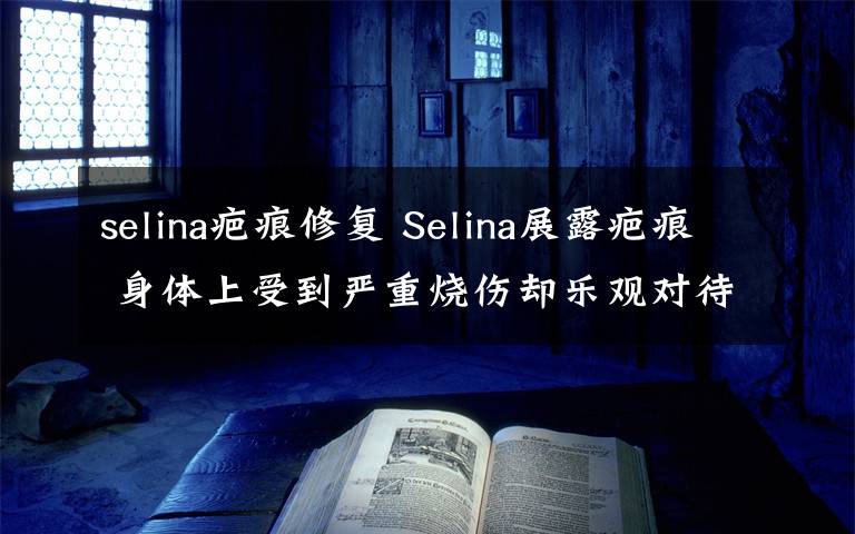 selina疤痕修复 Selina展露疤痕 身体上受到严重烧伤却乐观对待