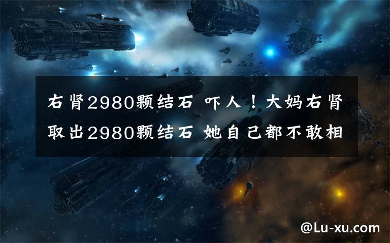 右肾2980颗结石 吓人！大妈右肾取出2980颗结石 她自己都不敢相信这个结果