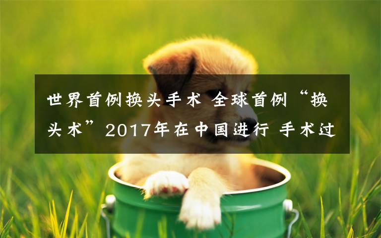 世界首例换头手术 全球首例“换头术”2017年在中国进行 手术过程非常复杂