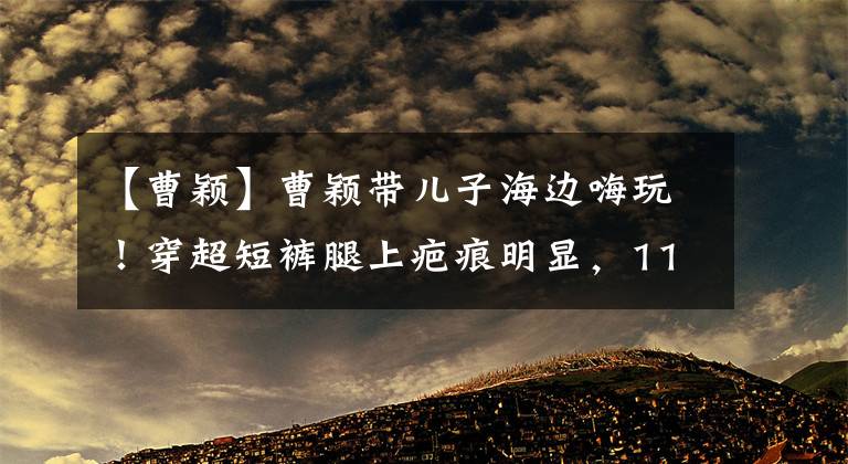 【曹颖】曹颖带儿子海边嗨玩！穿超短裤腿上疤痕明显，11岁儿子身高太抢镜