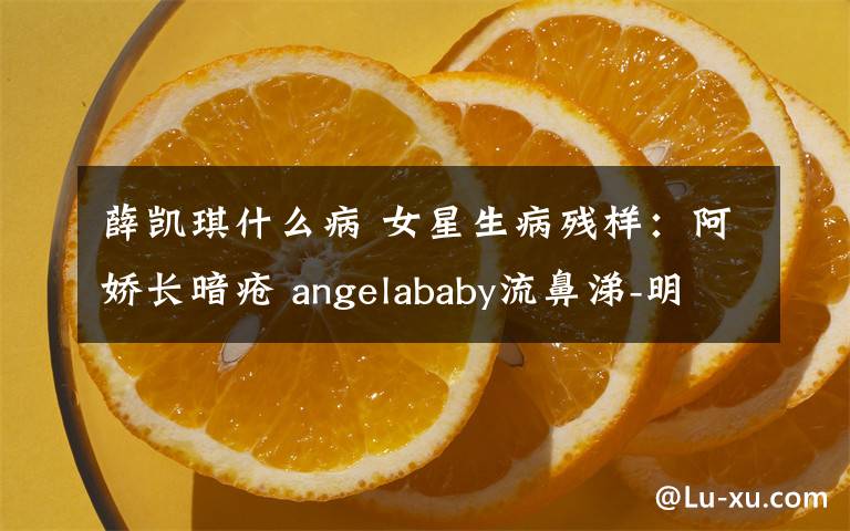 薛凯琪什么病 女星生病残样：阿娇长暗疮 angelababy流鼻涕-明星囧图- 东南网