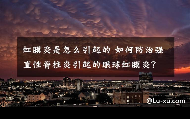 虹膜炎是怎么引起的 如何防治强直性脊柱炎引起的眼球虹膜炎？