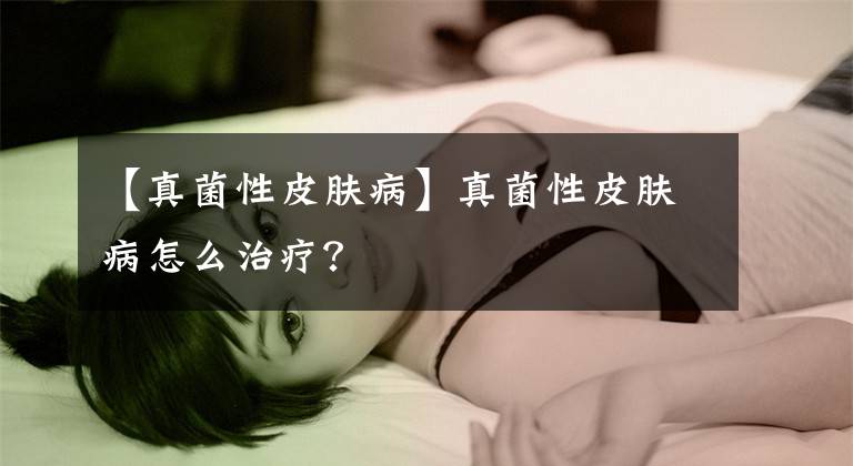 【真菌性皮肤病】真菌性皮肤病怎么治疗？