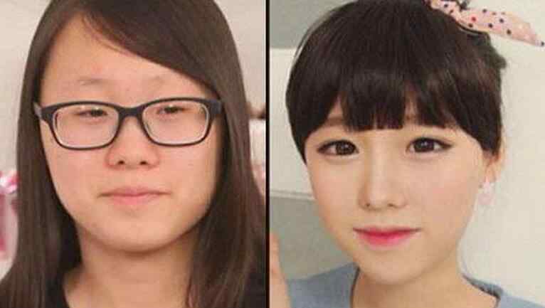 韩国整容前后 韩国美女照片 美女整容前后对比让人震撼