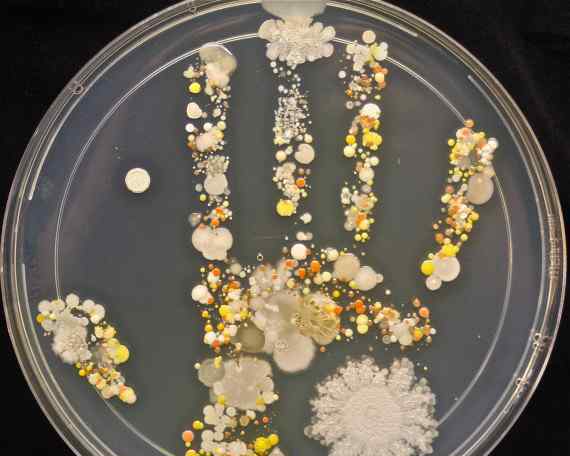 手上的细菌图片 图文：孩子的小手上有多少细菌？
