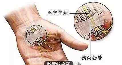肘关节和手指头肌张力训炼
