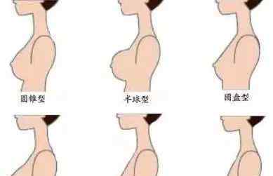 乳房形状和胸围尺寸,它是女孩一定要了解的专业知识