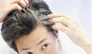 长白头发了是什么原因 头发白是什么原因 常见引起头发白的原因介绍