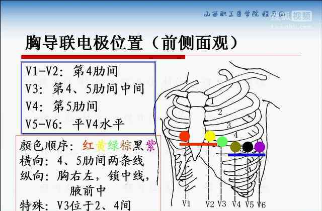 心电图导联位置颜色图心电图导联位置图解大全心电图导联连接快速确定