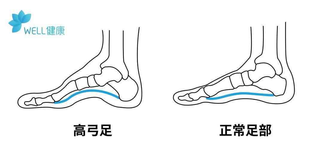 没有一切单一的手术治疗没法缓解疼痛