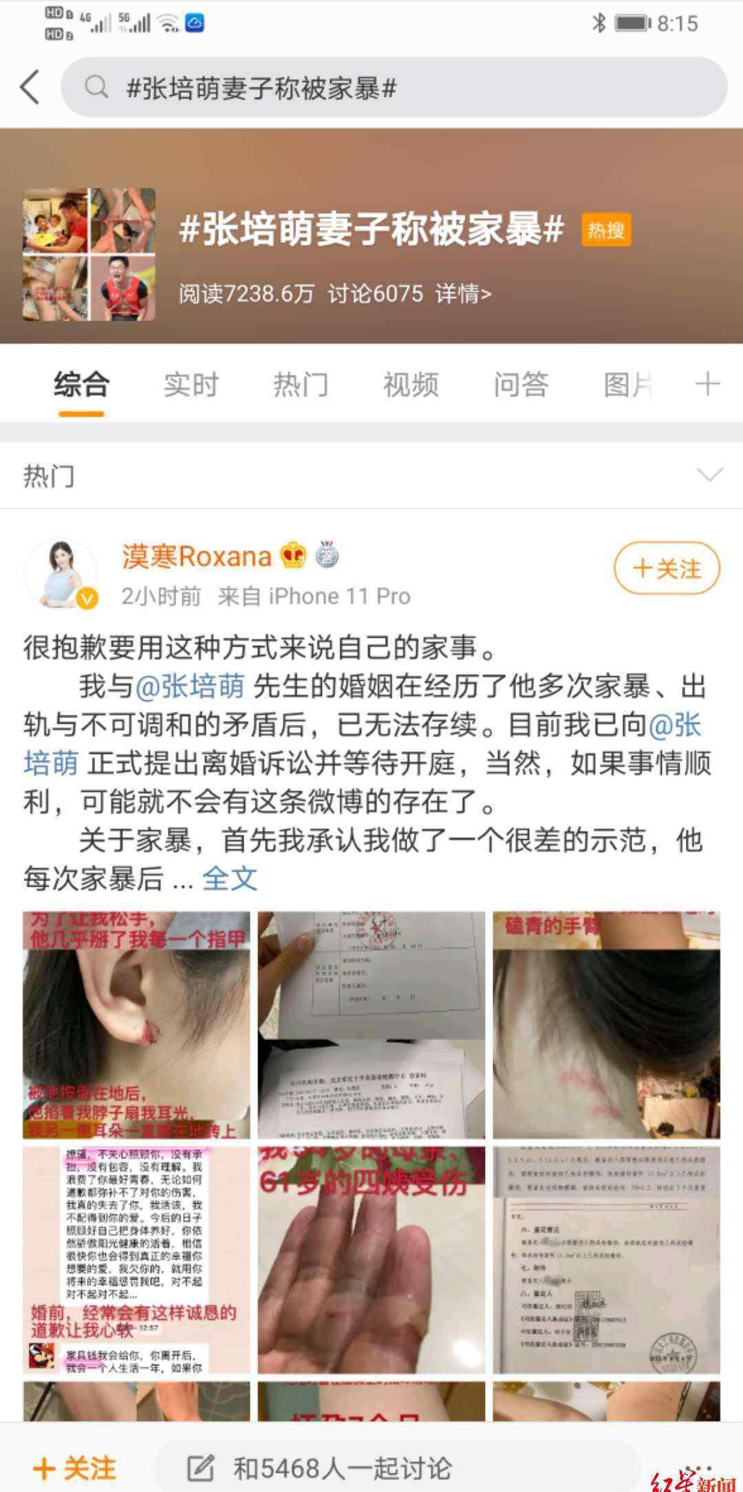 张培萌 【反转】张培萌妻子称只想要女儿抚养权 到底咋回事?