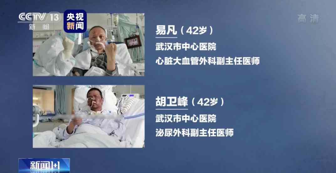 脸黑是什么病的前兆 令人揪心!武汉面容变黑医生出现脑出血症状 具体是怎么回事?