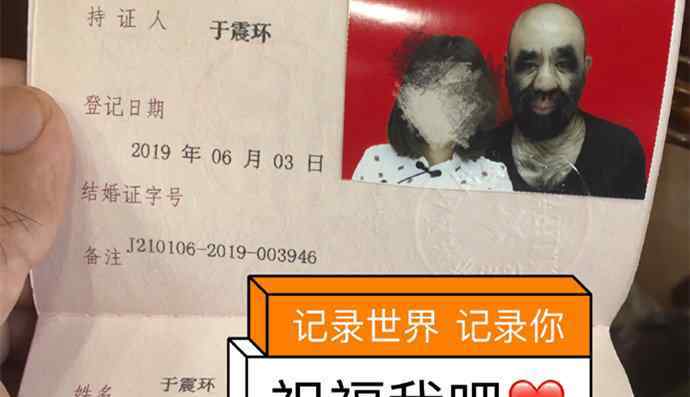 震寰 中国第一毛孩结婚了 于震寰个人资料起底老婆高颜值引热议