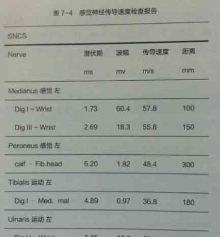 肌电图怎么做过程图片年轻医生快来看学习一下如何读懂肌电图