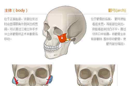 怎么变瓜子脸 大方脸整容，怎样才能变成瓜子脸？