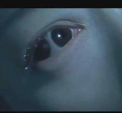现实中双瞳人的照片 双瞳是怎么形成的 电影中的双瞳少女最后成仙了吗