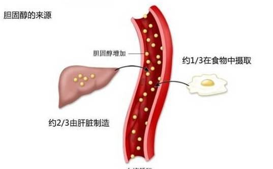 一年一度体检，胆固醇偏高怎么办（全攻略）