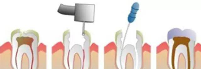 牙科诊所口腔咨询对话（超实用）-口内篇