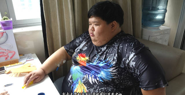 巨胖加减肥术后半年减182斤，主刀医生王存川教授说未来的一年还能减重100多斤