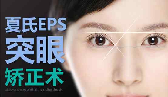 突眼症 夏氏EPS突眼矫正术——突眼症患者的福音