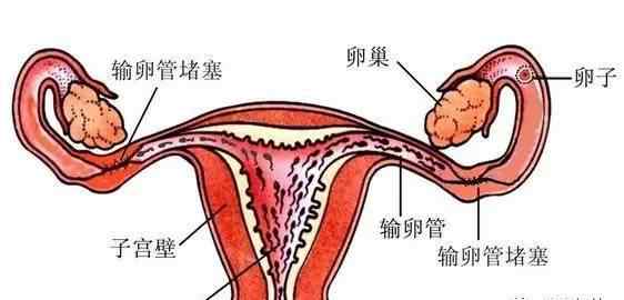 输卵管造影疼吗 做子宫输卵管造影到底疼不疼