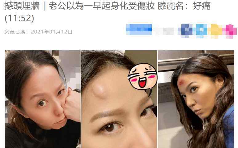 滕丽名老公 意外撞墙哭笑不得！44岁TVB女星滕丽名额头肿包隆起，却被富商老公当成故意化妆