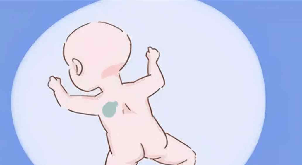 胎记产生的原因 宝宝出现胎记的原因是什么？该怎样预防呢？