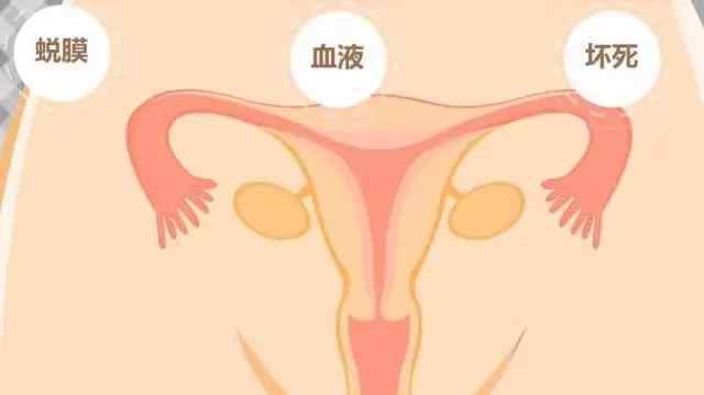 产后恢复排卵征兆 产后恢复那点事：如何判断子宫恢没恢复好？月经啥时候来报道？