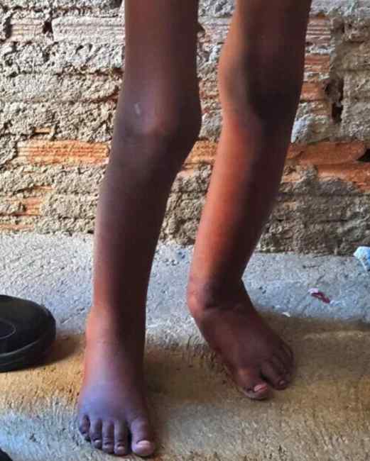 巴西11岁男孩被父亲锁铁桶中3天：只能站立 没有食物