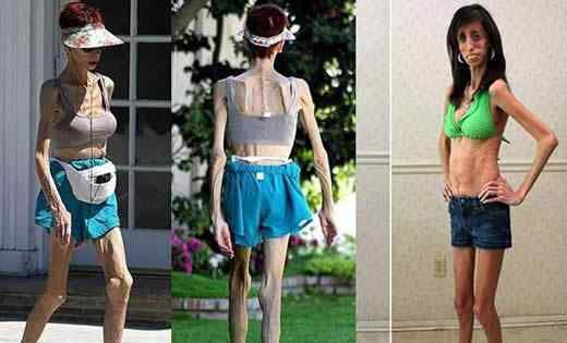 世界上最瘦的女人 世界上最瘦的女人，像纸人一样