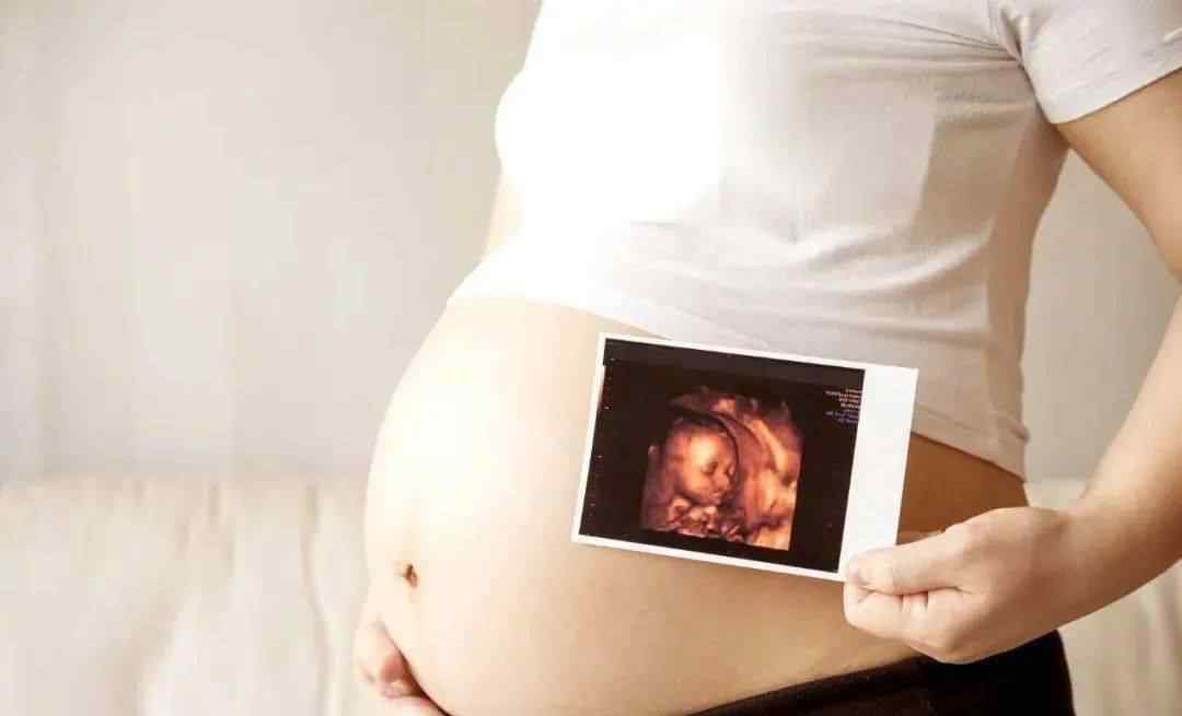 大排畸检查 孕期“大排畸”检查，发现胎儿异常怎么办？