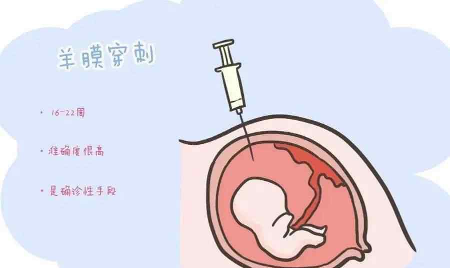 大排畸检查 孕期“大排畸”检查，发现胎儿异常怎么办？