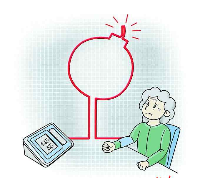 65岁老人血压多少正常 权威！老年人高压139也正常！刚刚发布老年人血压管理指南