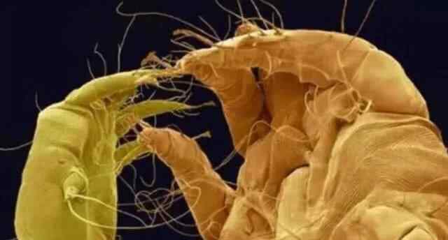 3000倍显微镜下的寄生虫长什么样子