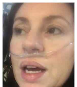 英国一名新冠肺炎女子在重症监护室ICU里录制视频