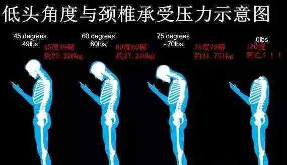 低头玩手机=头顶 50 斤还有严重后果意想不到…