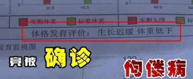 三鹿奶粉事件 “大头娃娃”再现，堪比12年前的三鹿奶粉事件，网友：实在无法原谅