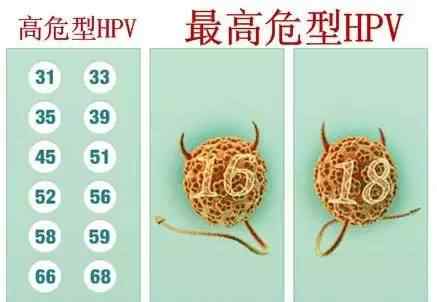 宫颈hpv52阳性普遍吗 HPV阳性，不要盲目恐慌！