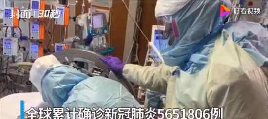 全球确诊逾565万 世界各国目前情况如何