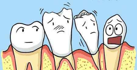 大牙齿松动 牙齿为什么会突然变松动？应警惕这4大诱因