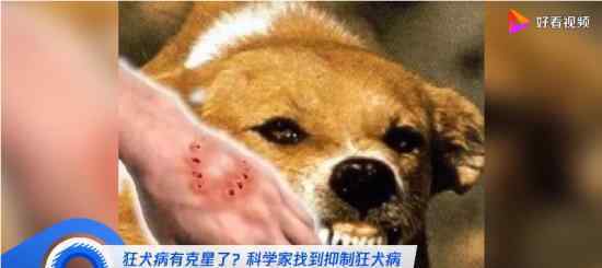 科学家找到抑制狂犬病毒关键开关 具体是什么情况