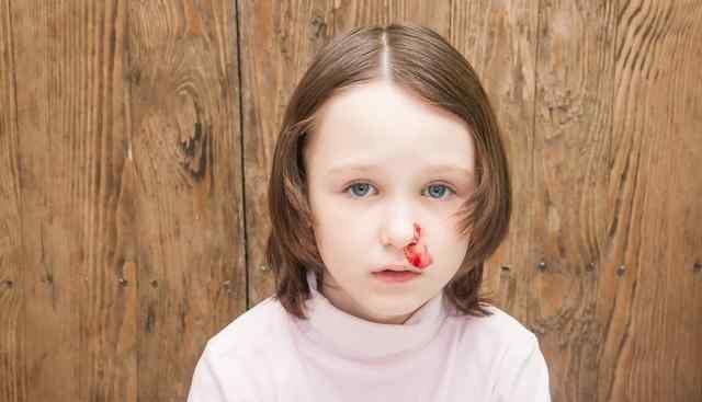 儿童鼻子经常出血是什么原因 小孩经常流鼻血是怎么回事？4个原因可以解释清楚