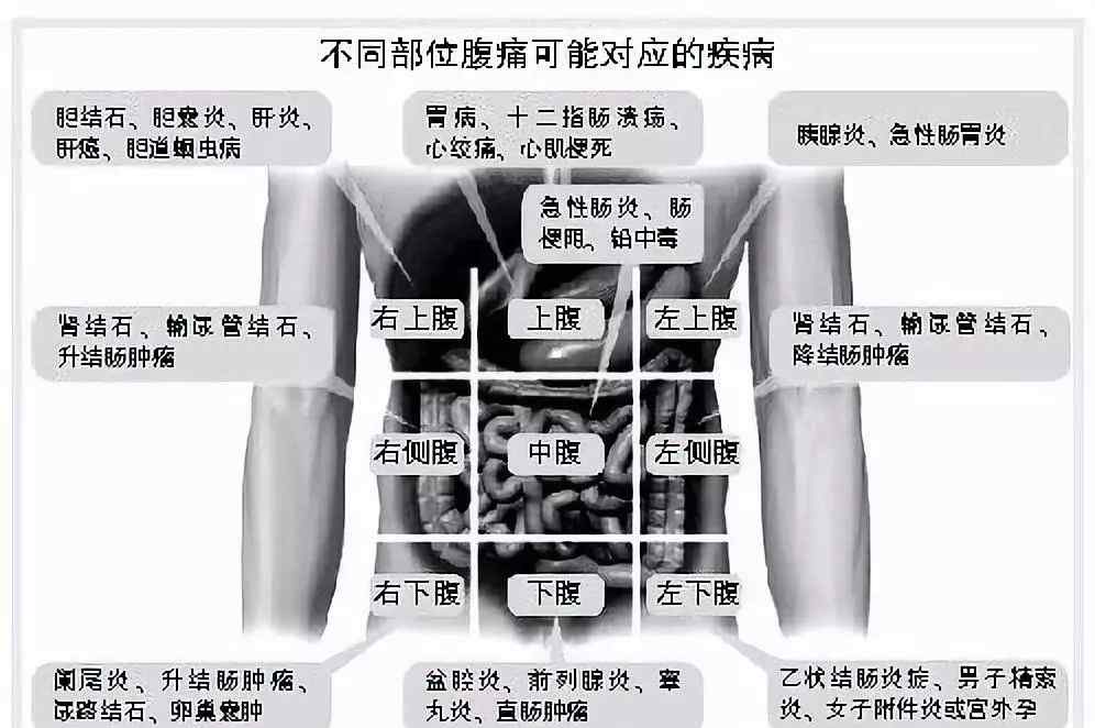 胰腺在腹中的位置图 肚子疼，到底是哪里出了问题？一张图帮你初步判断，找对科室！