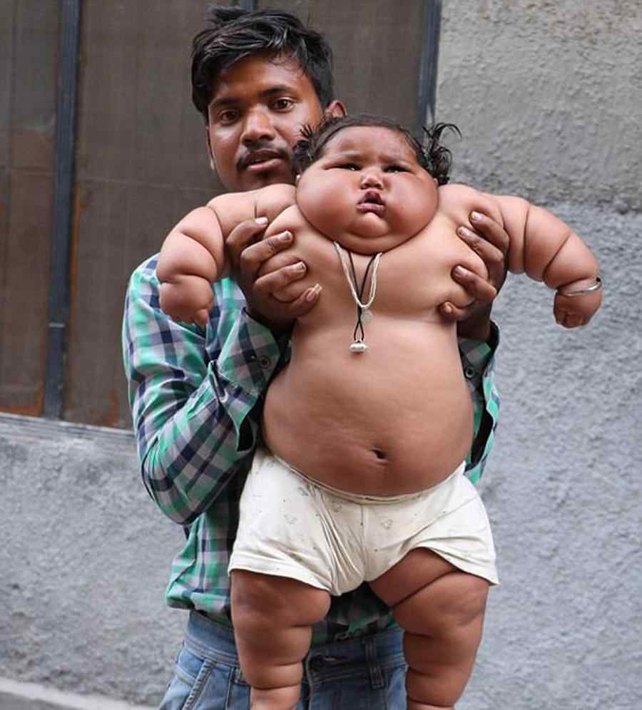 8个月女婴重35斤 食量惊人如10岁孩童