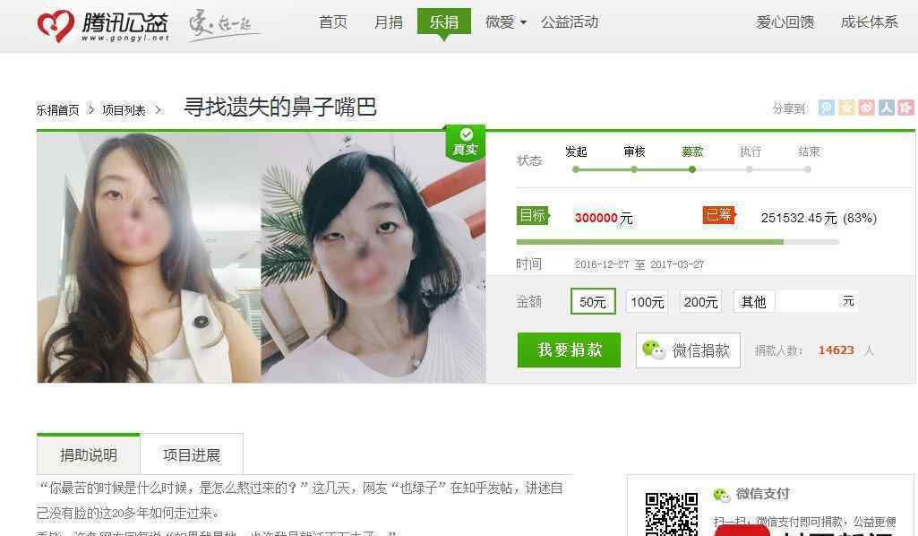 无鼻女网络求助引争议用iphone7还缺钱？这次又是利用了人们的善良吗？