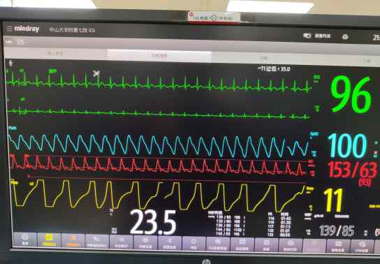 监护 ICU的床旁监护，你会看吗？