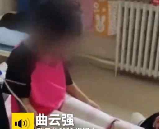 遭亲爸后妈虐待女童需整形治疗 什么情况严重吗