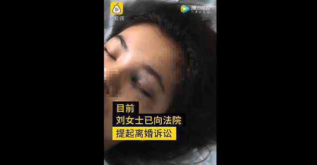 妻子不堪丈夫暴打为逃生跳楼摔成瘫痪 监控拍下揪心全程